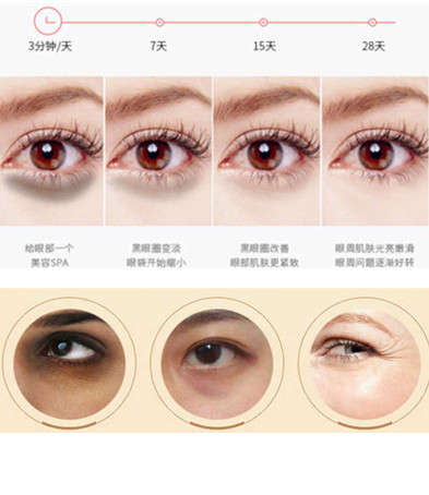 Electric eye massager